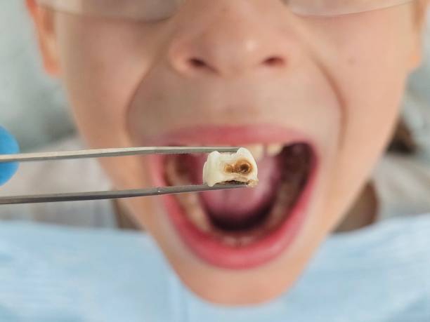 Best Weekend Emergency Dental Services in Perry, OK